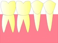Les dents d'une même arcade sont côte à côte et restent 