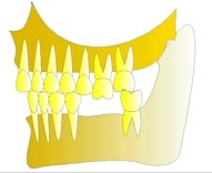 Si la deuxième prémolaire du bas est manquante, la molaire du haut n'a plus du tout d'appui et régresse vers le bas. Il n'y a plus d'auto-nettoyage par la mastication, la dent va se carier et se recouvrir de tartre.