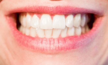 Prophylaxie individuelle : actes nouveaux pour prévenir l’apparition des caries