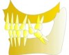 Pourquoi faut-il remplacer les dents manquantes ?