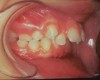 L’orthodontie chez l’enfant et l’adulte