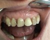 <i class="fa fa-video-camera" aria-hidden="true"></i> La dentisterie du sourire