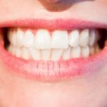 Le grincement des dents : le bruxisme
