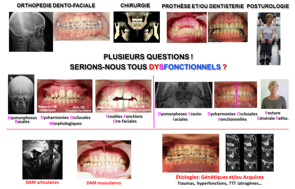 Cranio-Facial-Universe et Réhabilitation Mandibulaire Morpho-Fonctionnelle 2