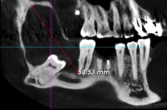 FIG.1