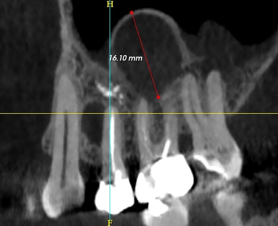 FIG.5