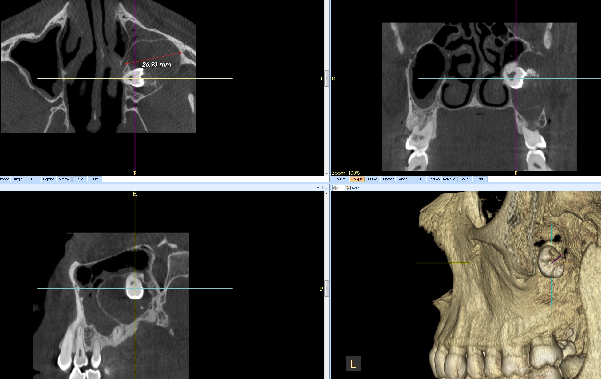 FIG.6