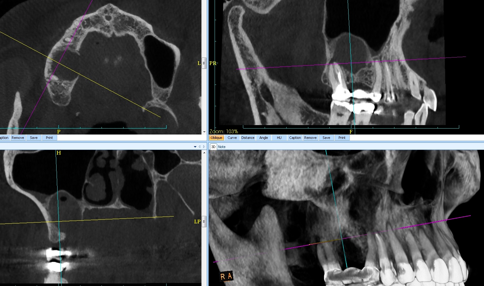 FIG.7