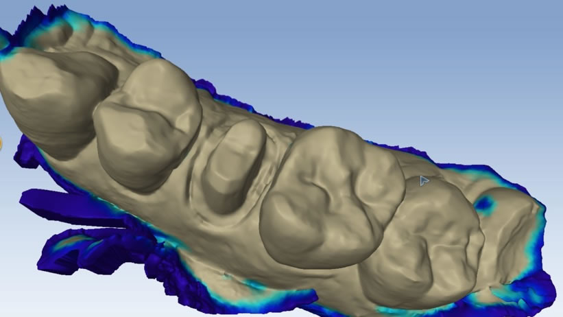 Modèle 3D issu de l’empreinte