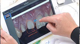 abcdentipad