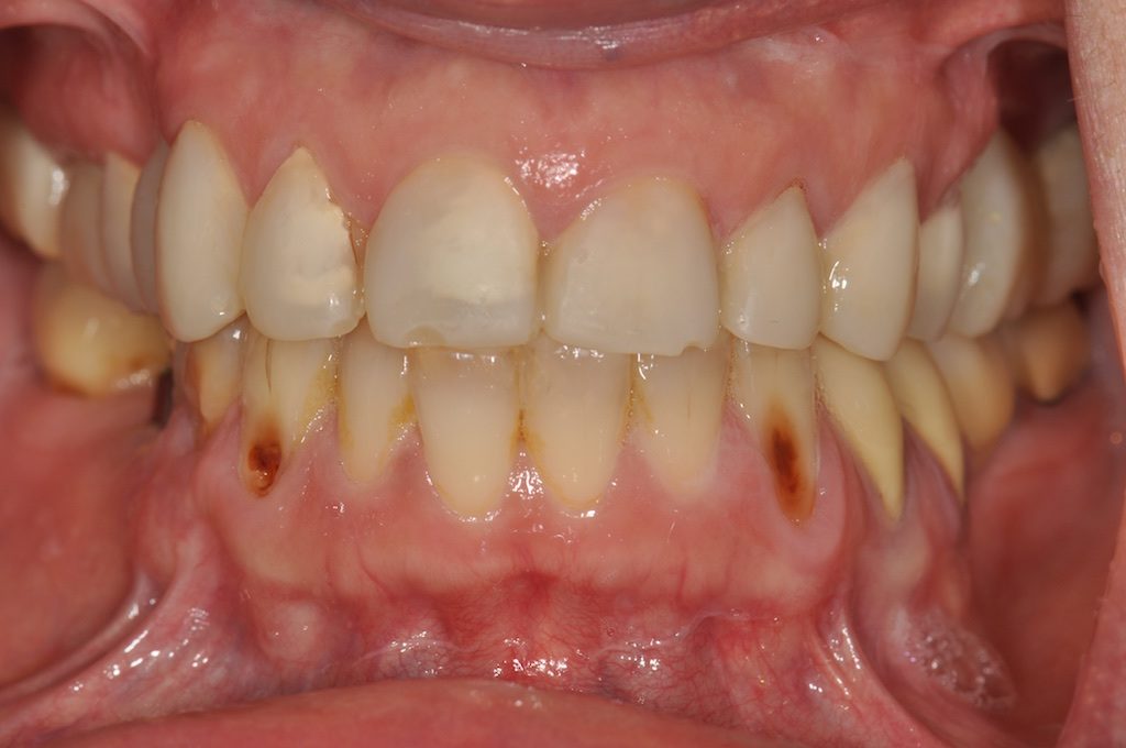 Fig. 6a