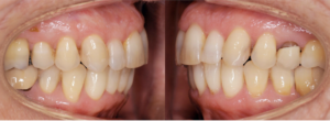 Figure 10bis