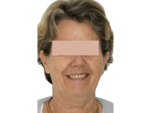 patient vieillissant