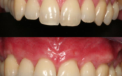 dentiste-formation-muco