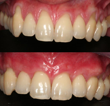dentiste-formation-muco