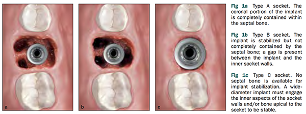 figure1