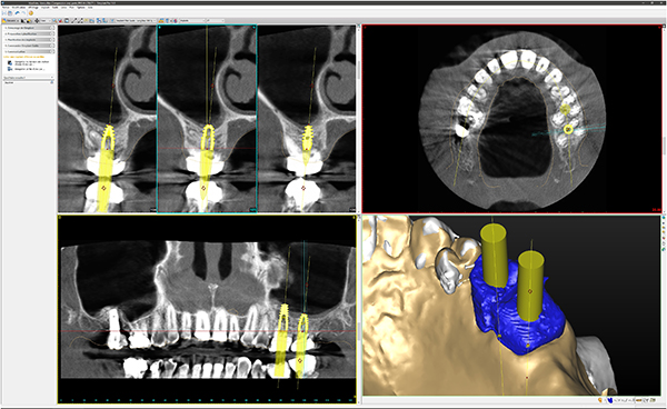 figure2