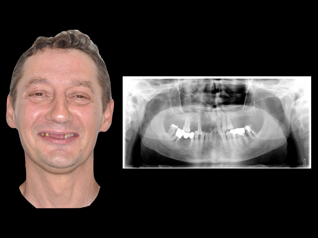 Fig 9