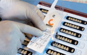Vignette-Site-CRB-Tuto-prothese-4
