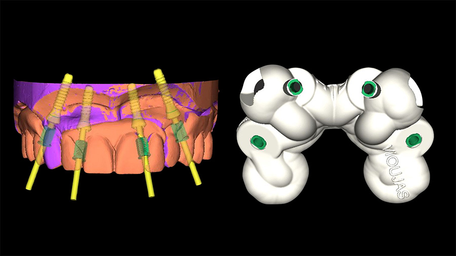 Fig 21