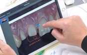 abcdentipad