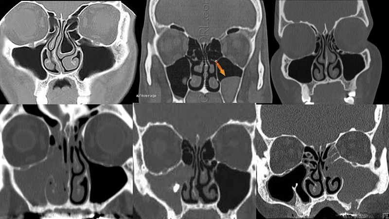 Diapositive4