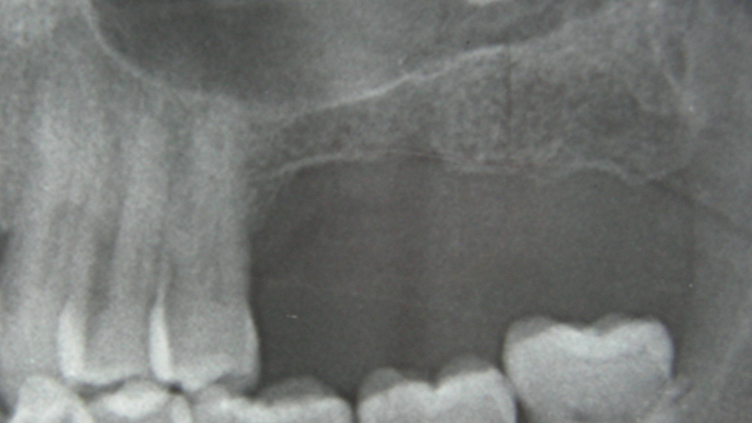 Diapositive32