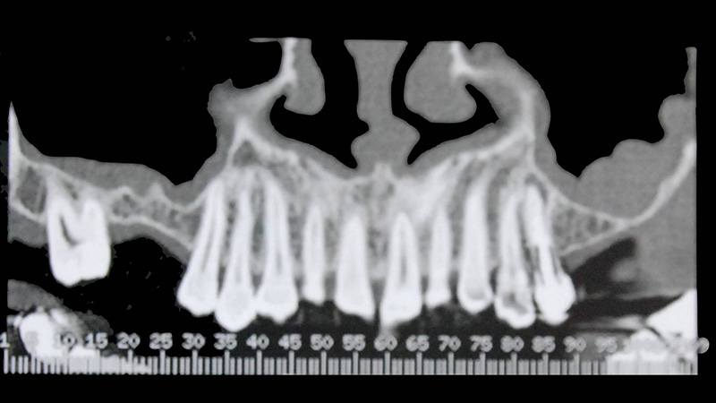 Diapositive38
