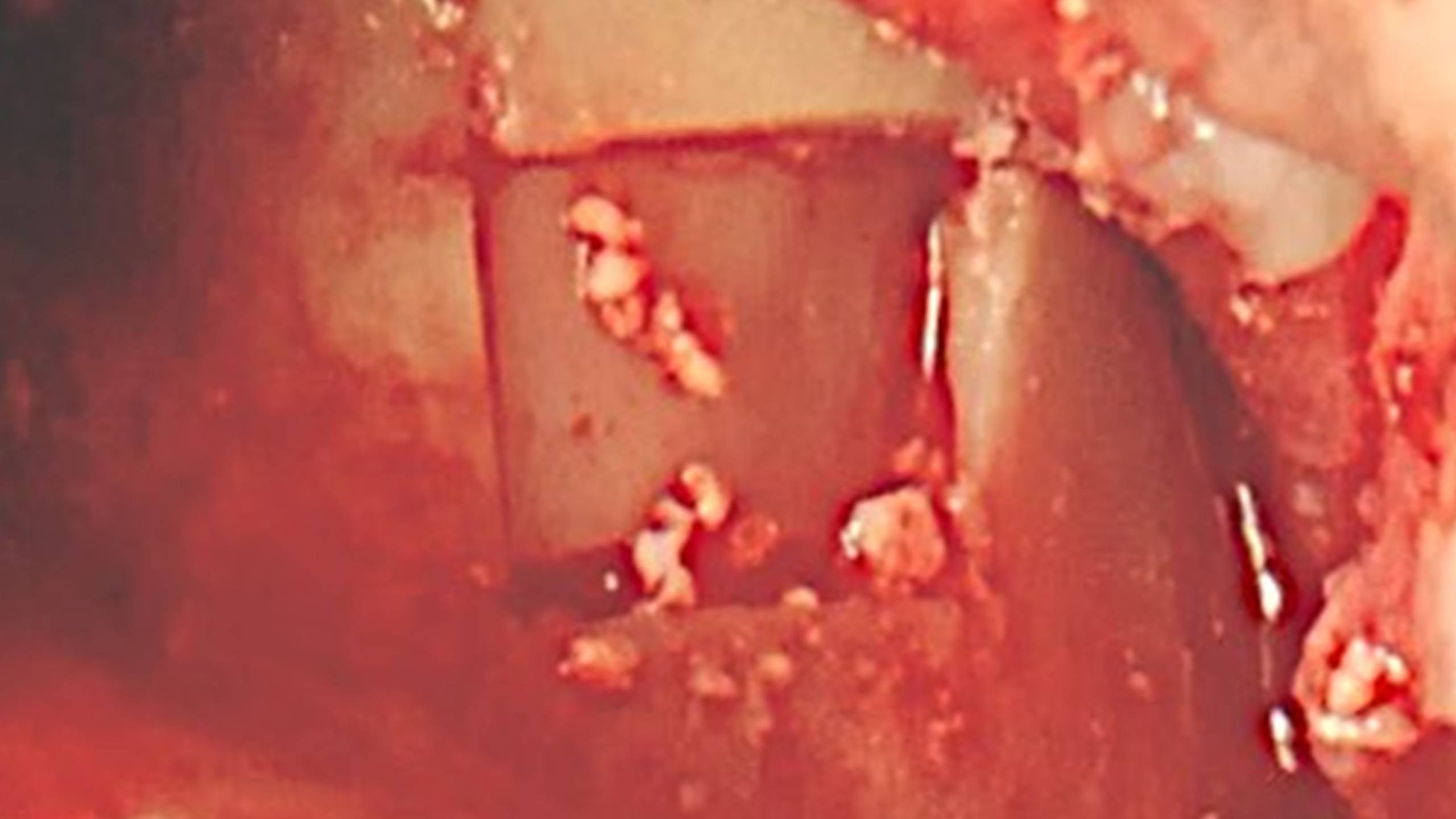 Diapositive45