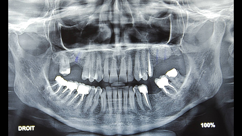 Diapositive46