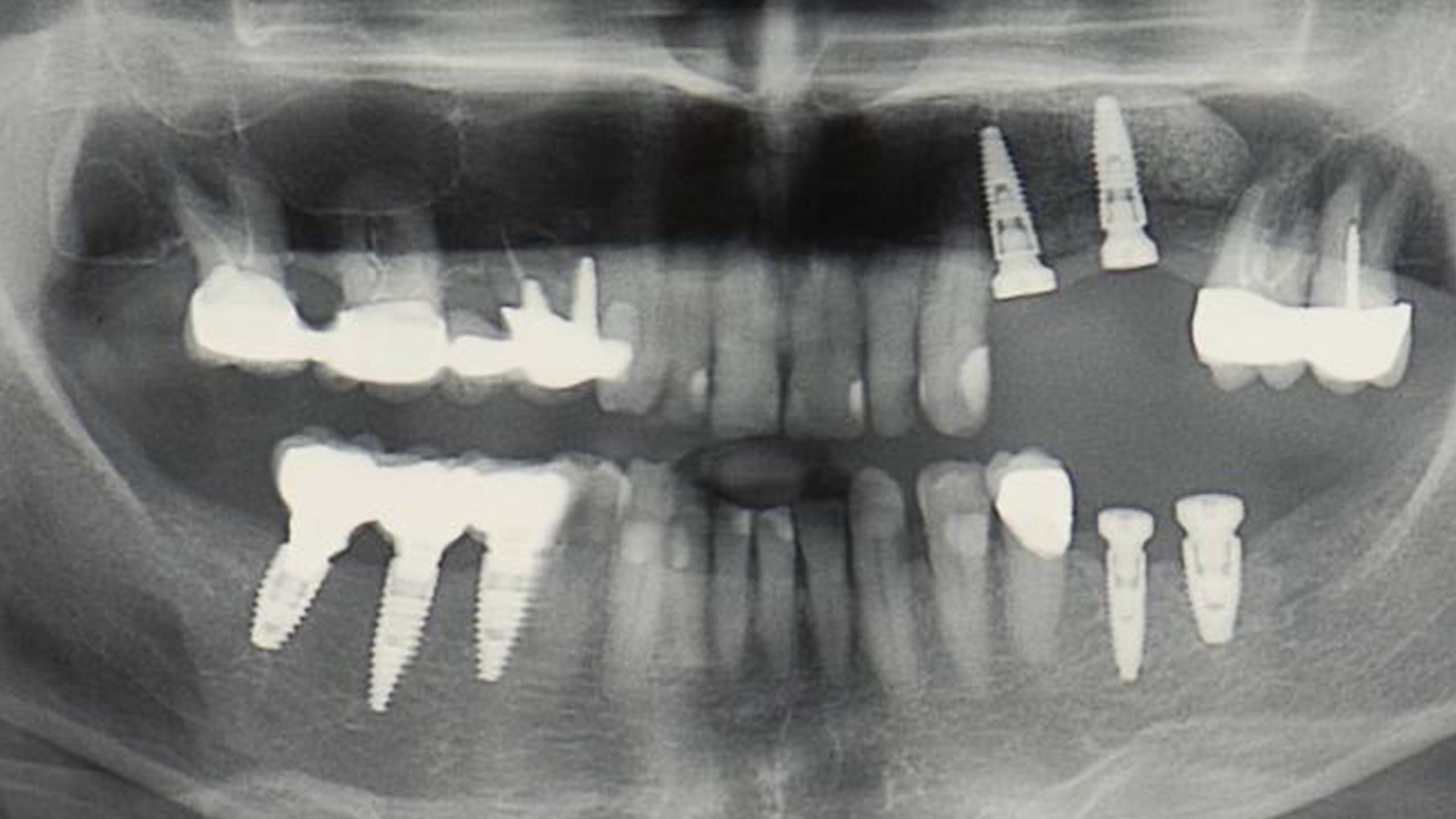 Diapositive78