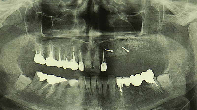 Diapositive83