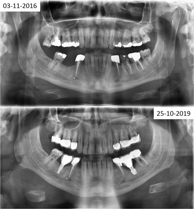 Fig 01-02