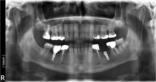 Fig 03