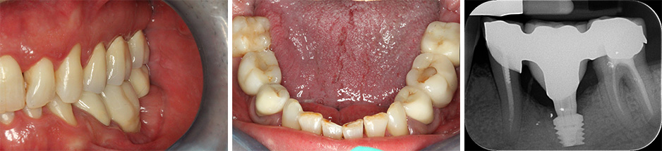 Fig 04-05-06