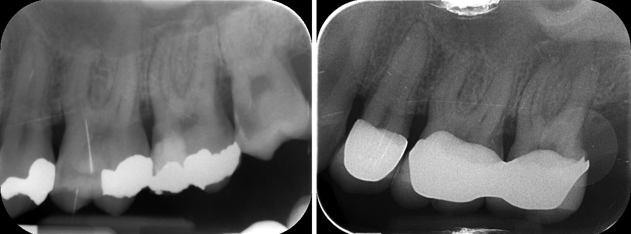 Fig 10-11