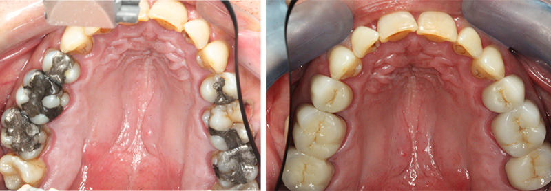 Fig 12-13