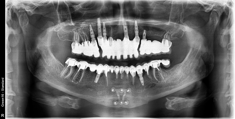 Fig 14
