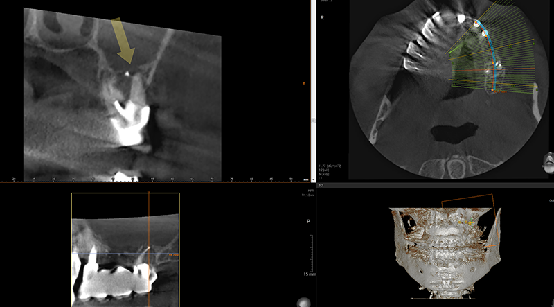 Fig 15