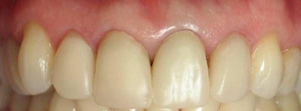 Image3