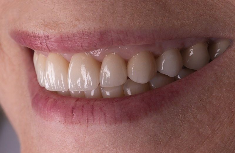Sourire-patiente