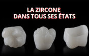 Vignette-zircone-FB