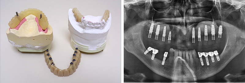 Modèle et radiographie