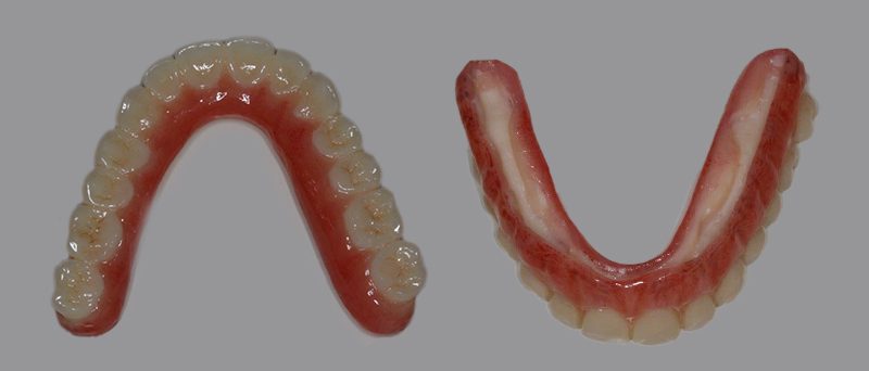 Duplicata résine