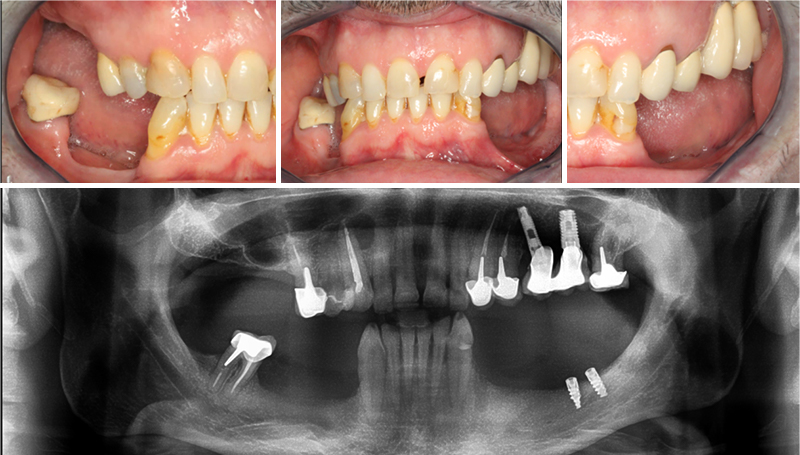Fig-01-situation-initiale