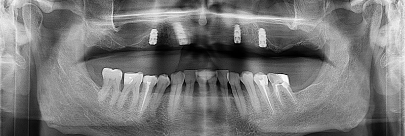 Fig-12-radiographie