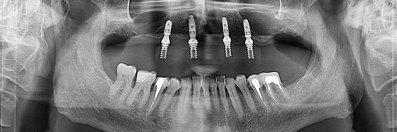 Fig-13-radiographie