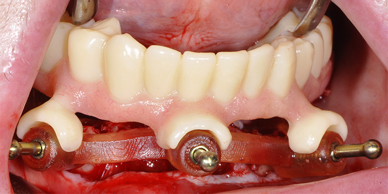 Fig-30