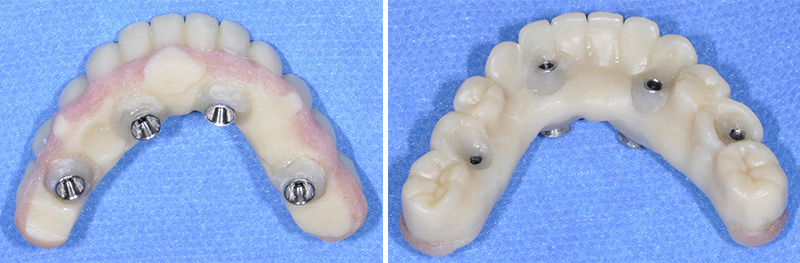 Fig-31-32