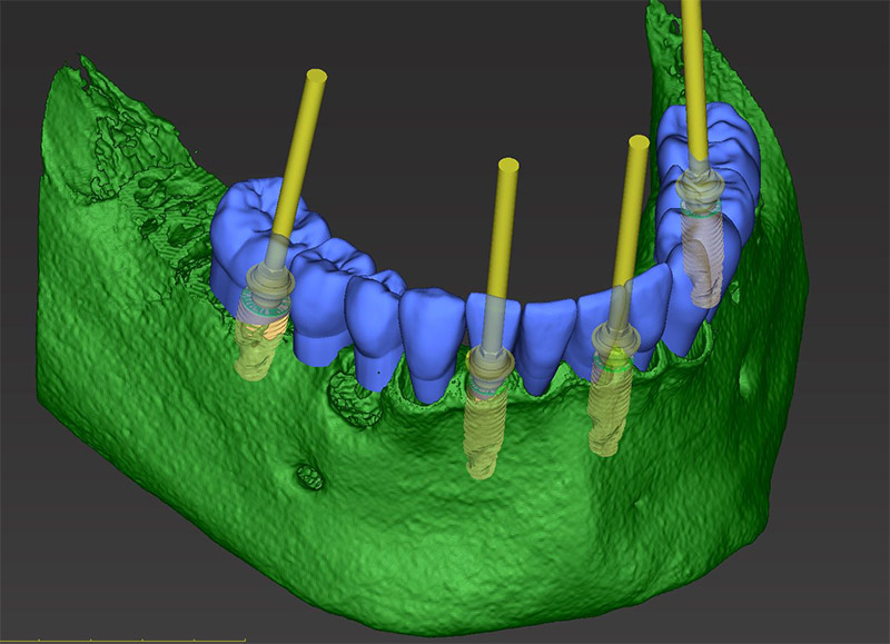 Fig-43